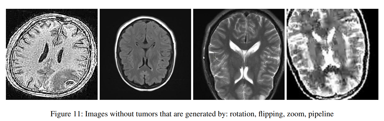 Augmentation examples
